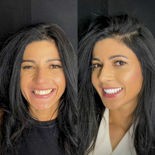 Antes e depois de tratamento dental na Odonto Light