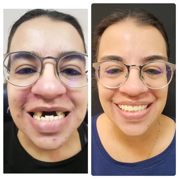 Fernanda, paciente da Odonto Light