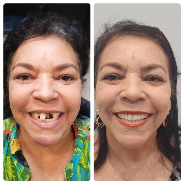 Dona Neide, paciente da Odonto Light