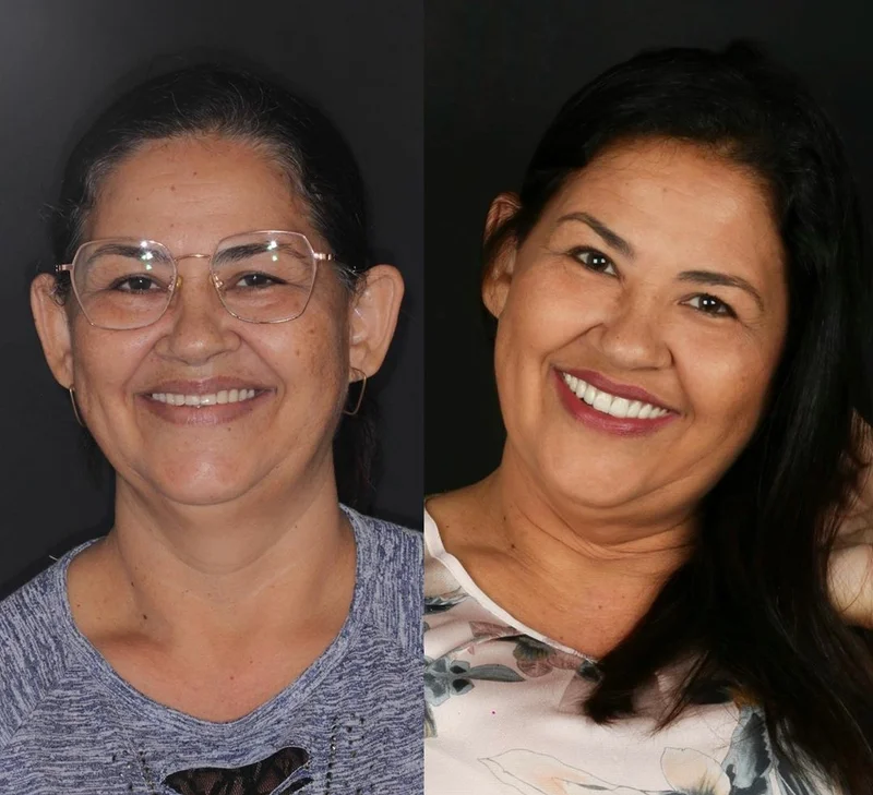 Paciente sorrindo após tratamento na Odonto Light