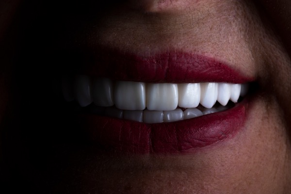 Lentes de contato dental